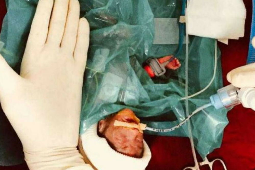 Righima Ajmani, najmniejszy noworodek, waga noworodka